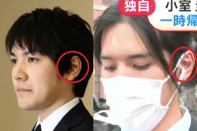 21 小室圭の顔変わった 目や鼻は整形 渡米前と画像比較 Xoxブログ 21 小室圭の顔変わった 目や鼻は整形 渡米前と画像比較 Xoxブログ