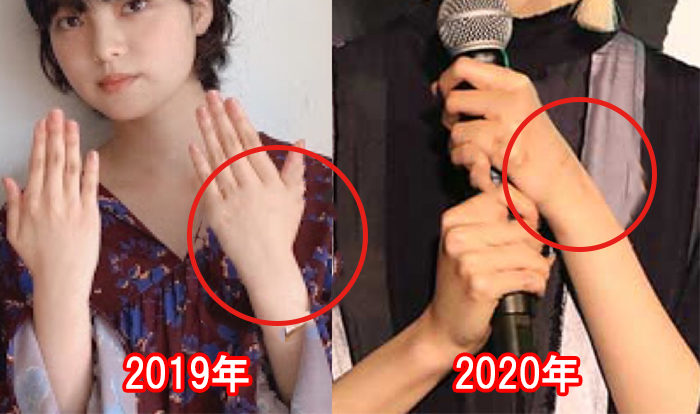 平手友梨奈 激痩せして細すぎと話題 吐きダコがあると噂も 画像検証してみた Xoxブログ