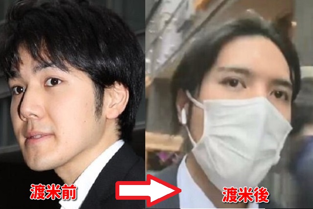 21 小室圭の顔変わった 目や鼻は整形 渡米前と画像比較 Xoxブログ 21 小室圭の顔変わった 目や鼻は整形 渡米前と画像比較 Xoxブログ