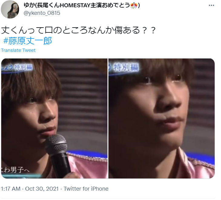 画像 藤原丈一郎は口唇口蓋裂 口元の傷はケガでいつから 幼少期から調査 Xoxブログ