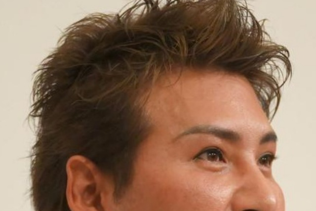 新庄剛志のおでこが広い ハゲが進行中で植毛しているとの噂 比較画像で検証 Xoxブログ 新庄剛志のおでこが広い ハゲが進行中で植毛しているとの噂 比較画像で検証 Xoxブログ