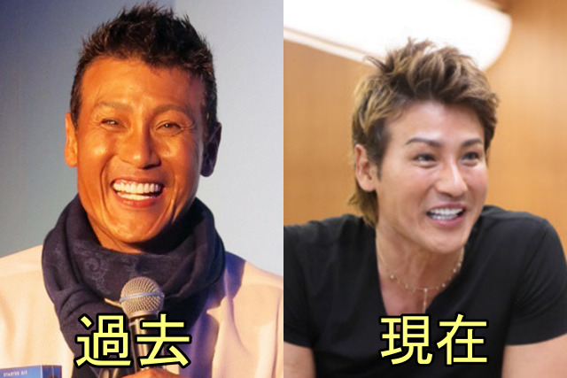 新庄剛志のおでこが広い ハゲが進行中で植毛しているとの噂 比較画像で検証 Xoxブログ 新庄剛志のおでこが広い ハゲが進行中で植毛しているとの噂 比較画像で検証 Xoxブログ